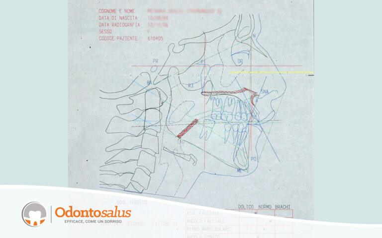 01schema